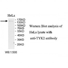 TYK2 Antibody