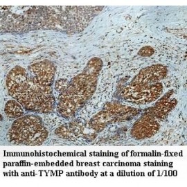 TYMP Antibody