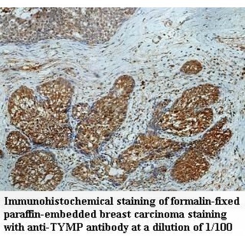 TYMP Antibody