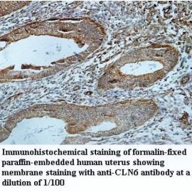 CLN6 Antibody