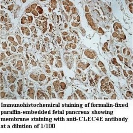 CLEC4E Antibody
