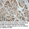 CLEC4E Antibody