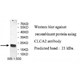 CLCA2 Antibody