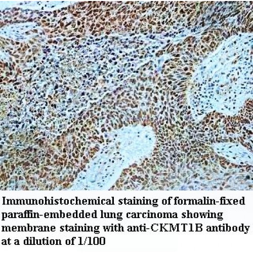 CKMT1B Antibody