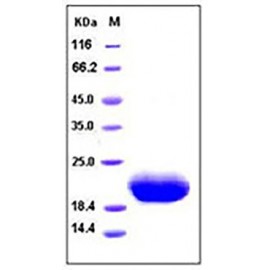 Human IL6/Interleukin-6 Protein