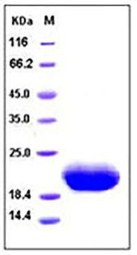 Human IL6/Interleukin-6 Protein