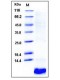 Human EGF/Epidermal Growth Factor Protein