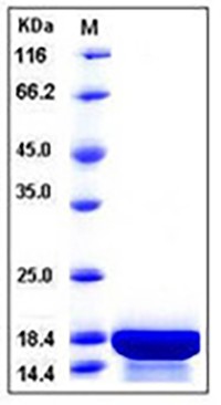 Human Interleukin-21 / IL-21 Protein