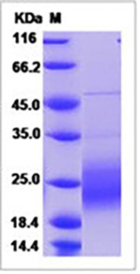 Human GM-CSF / CSF2 Protein