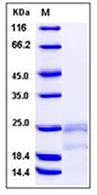 Human IFN-gamma / IFNG / γ-IFN Protein