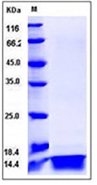 Human IL4 / Interleukin-4 Protein