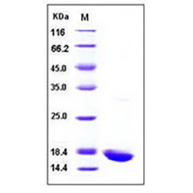 Human IL-1 beta / IL 1B Protein