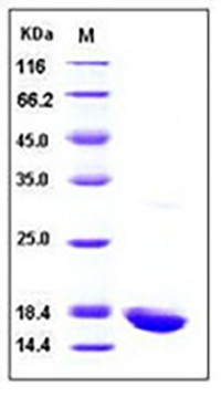 Human IL-1 beta / IL 1B Protein