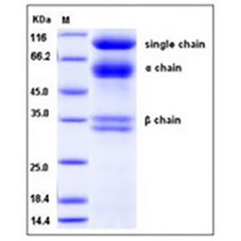 Human HGF / Hepatocyte Growth Factor Protein