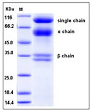 Human HGF / Hepatocyte Growth Factor Protein