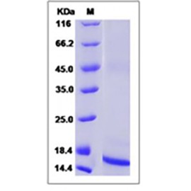 Rat / Mouse TGF-beta 1 / TGFB1 Protein