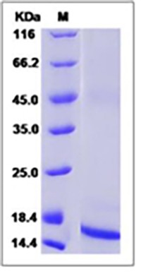 Rat / Mouse TGF-beta 1 / TGFB1 Protein