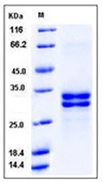 Human HMGB1 / HMG1 Protein (His Tag)