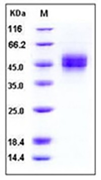 Human MICB Protein (His Tag)