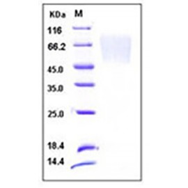 Human Fractalkine / CX3CL1 Protein (His Tag)