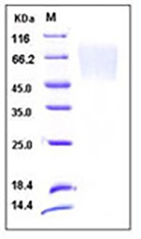Human Fractalkine / CX3CL1 Protein (His Tag)