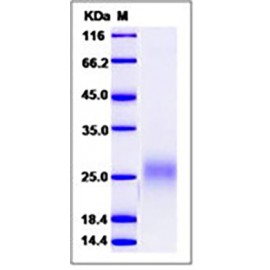 Human FLT3L / Flt3 ligand / FLT3LG Protein (His Tag)