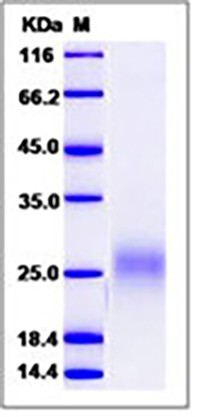 Human FLT3L / Flt3 ligand / FLT3LG Protein (His Tag)