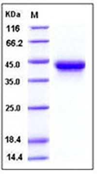 Human IL2Ra / CD25 Protein (His Tag)