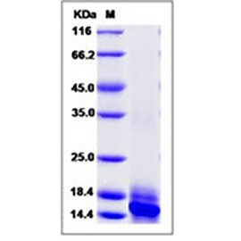 Human IL-15 / IL15 / Interleukin 15 Protein (His Tag)