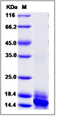 Human IL-15 / IL15 / Interleukin 15 Protein (His Tag)