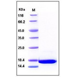 Human aFGF / FGF1 Protein