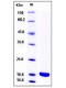 Rat IL-1 beta / IL1B Protein (mature form)