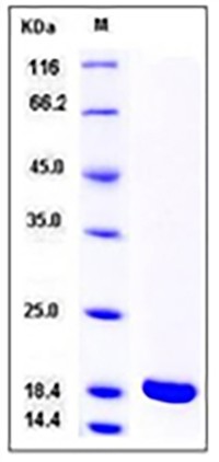 Rat IL-1 beta / IL1B Protein (mature form)