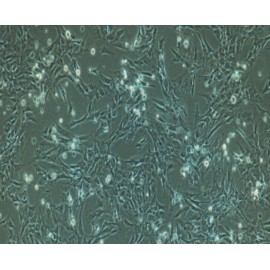 Pulmonary Microvascular Endothelial Cells