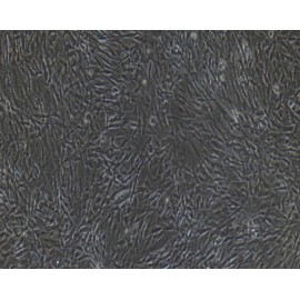 Human Primary Type II Alveolar Epithelial Cells