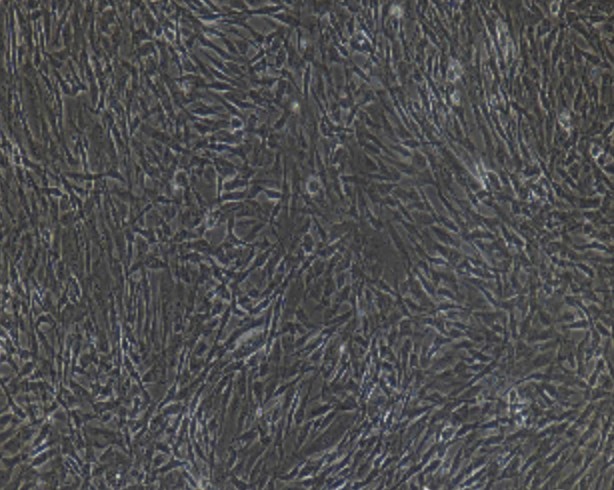 Human Primary Type II Alveolar Epithelial Cells