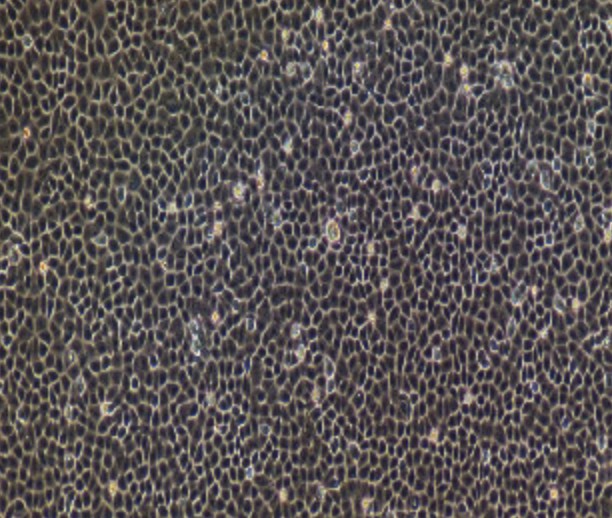 Human Primary Tracheal Epithelial Cells