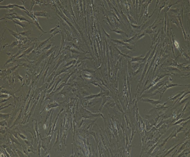 Human Primary Tracheal Smooth Muscle Cells