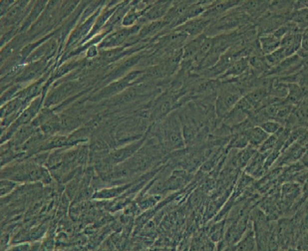 Human Primary Pulmonary Fibroblasts Cells