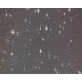 Human Primary Cardiac Muscle Cells