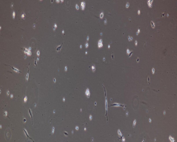 Human Primary Cardiac Muscle Cells