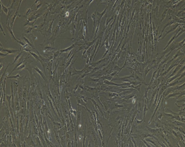 Human Primary Coronary Artery Endothelial Cells