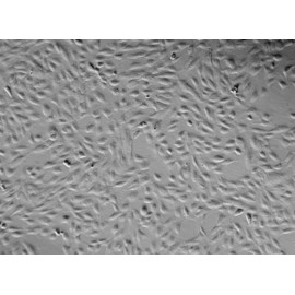 Human Primary Pulmonary Artery Endothelial Cells