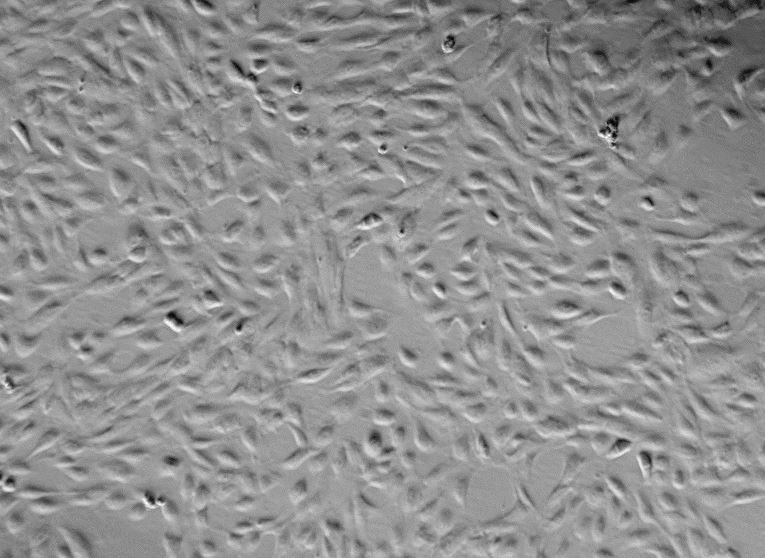 Human Primary Pulmonary Artery Endothelial Cells