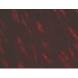 Human Primary Aortic Valve Mesenchymal Cells