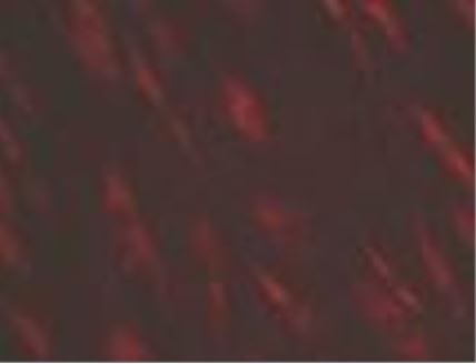 Human Primary Aortic Valve Mesenchymal Cells