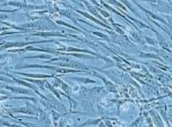 Human Primary Pulmonary Artery Smooth Muscle Cells