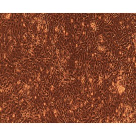 Human Primary Esophageal Epithelial Cells