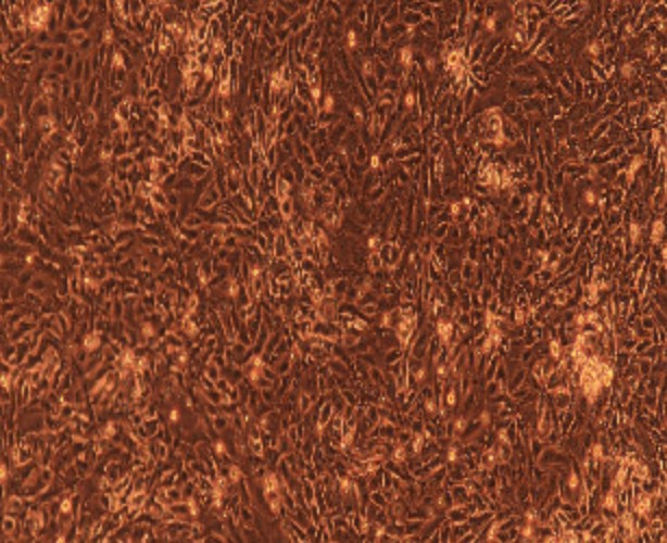 Human Primary Esophageal Epithelial Cells