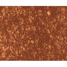 Human Primary Esophageal Smooth Muscle Cells